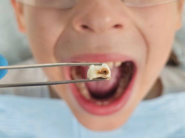 Best Emergency Pediatric Dentist  in Brookdale, NJ